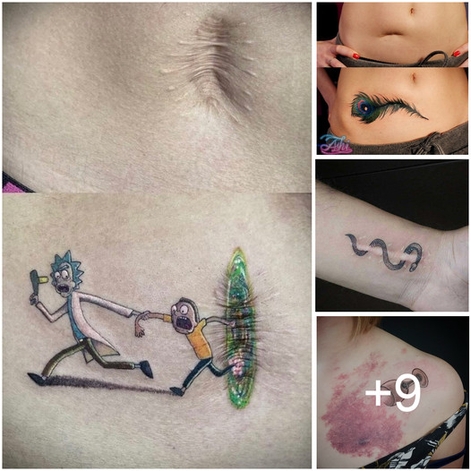Tattooists turn scars into works of art